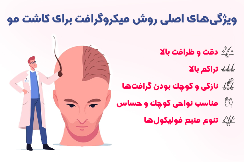 ویژگی های روش کاشت مو میکروگرافت