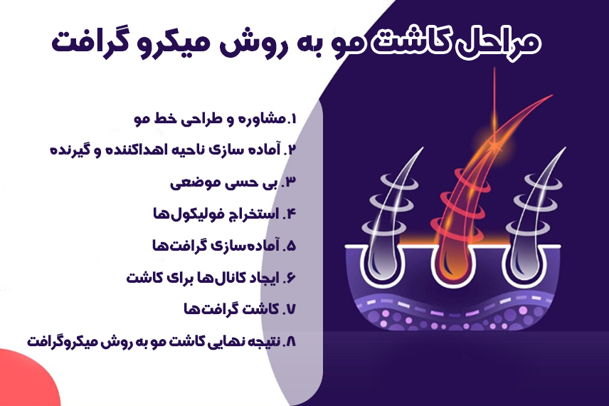 مراحل کاشت مو به روش میکروگرافت